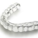 férula-dental-valencia-descarga-protesis
