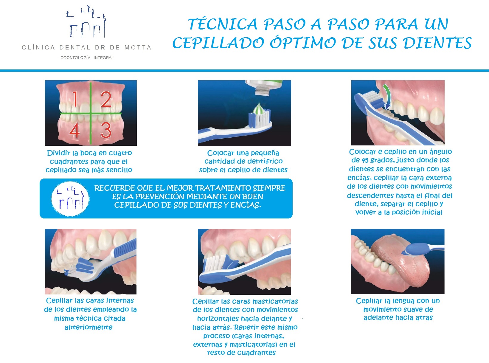 Tecnica De Cepillado Clinica Dental Dr De Motta